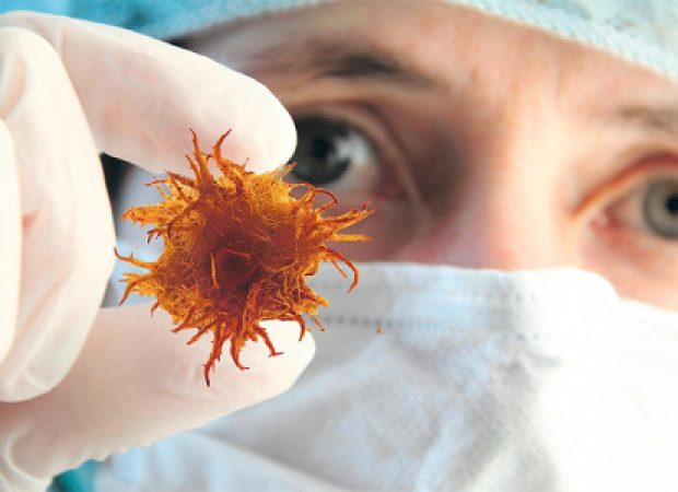 3 ay ömrü qalmışdı! Bu, onun həyatını xilas etdi, 4-cü dərəcəli xərçəngi sağaltdı!