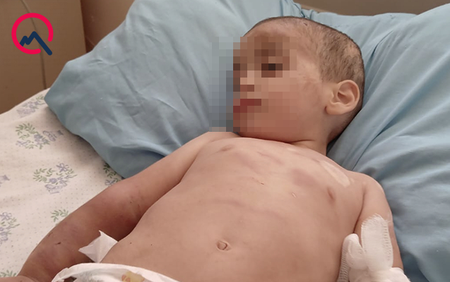 Ağdamda iki yaşlı uşaq döyülüb - Atası saxlanıldı