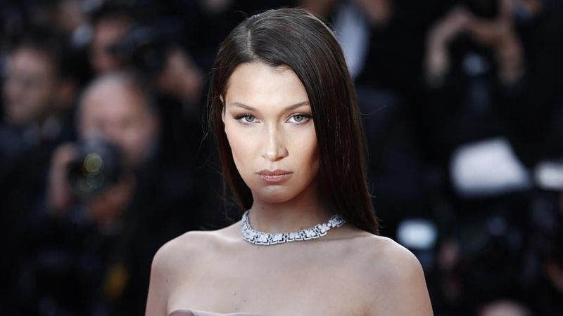 28 yaşlı modelin xəstəliyi kəskinləşdi, xəstəxanaya yerləşdirildi (FOTO)