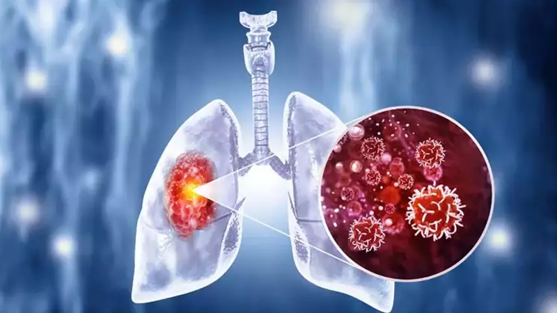 Dünyanın ən ölümcül yoluxucu xəstəliyi: Hər il bir milyon insan öldürür