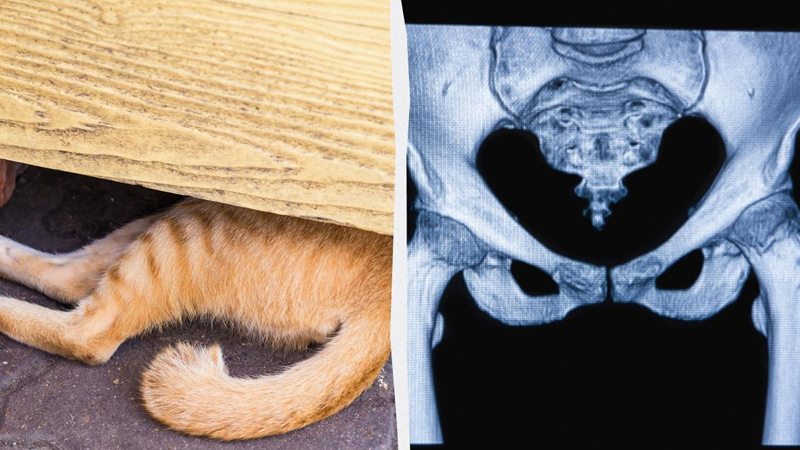 İnsanların quyruğu niyə yoxdur? - Alimlər təkamül sirrini açdılar