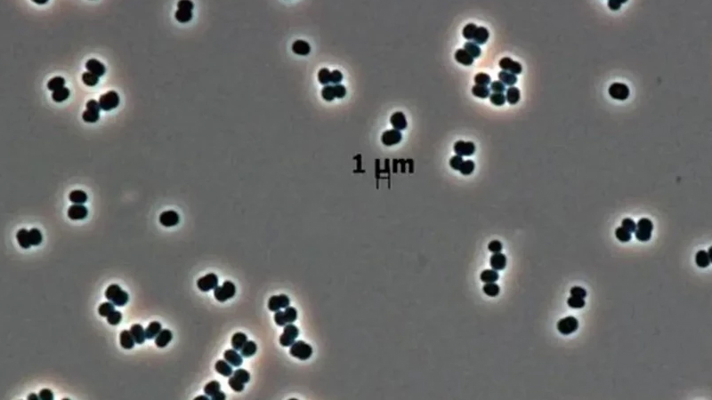 Ölü kimi davranan super bakteriyalar kosmosu da təhdid edir