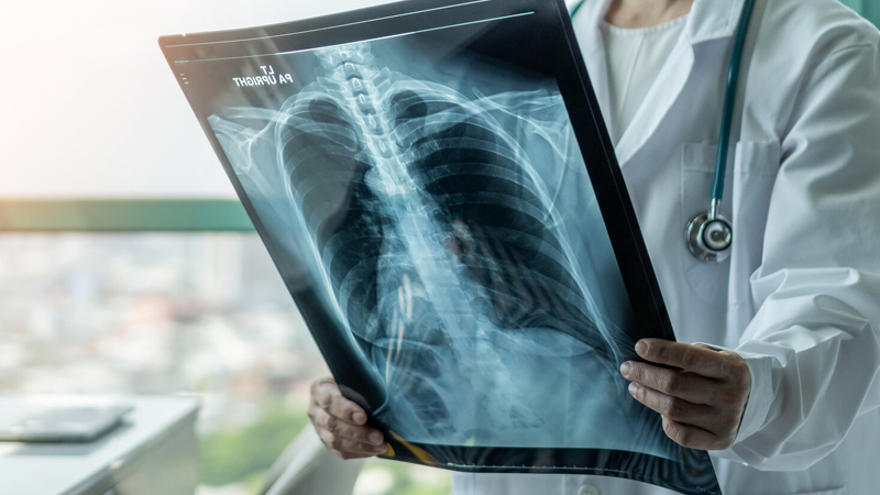 Yaşlılarda D vitamini çatışmazlığının təhlükəli bir nəticəsi açıqlandı