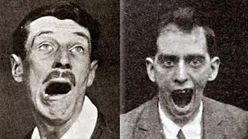 Tarixin ən sirli xəstəliyi: Yarım milyon insanı öldürdü, bir anda yox oldu