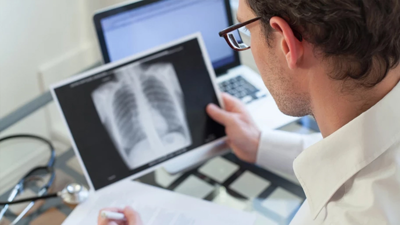 Milyonlarla xərçəng hadisəsinin arxasındakı təəccüblü həqiqət