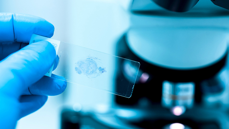 Dünyada xərçəng göstəricisinin ən yüksək olacağı region açıqlandı