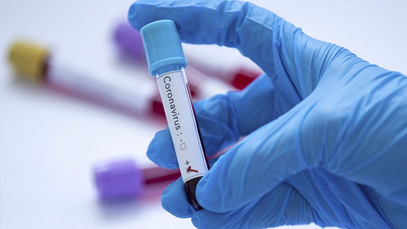 Taylandda yarasalarda yeni koronavirus növü aşkarlandı