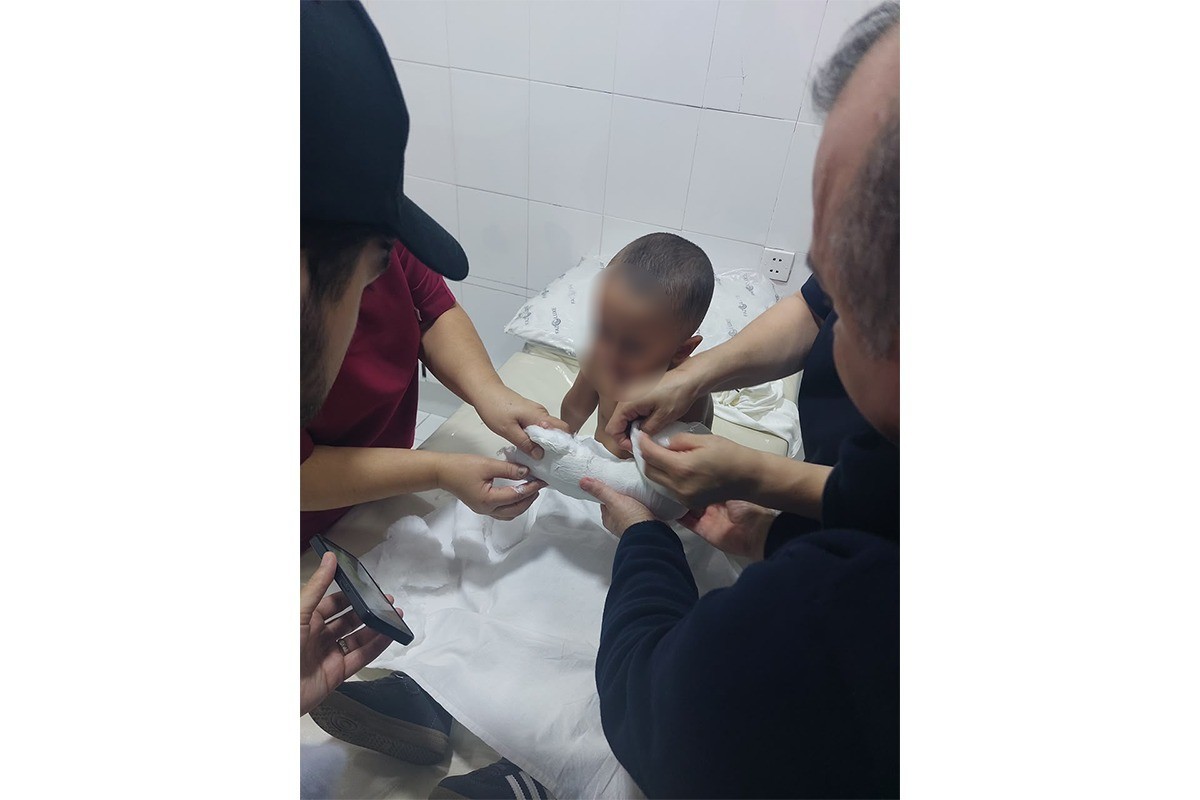 "Laləli" bağçasında sürüşkəndən yıxılan uşağın qolu sındı (VİDEO)