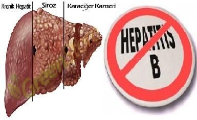 Hepatit C haqqında bilmədikləriniz