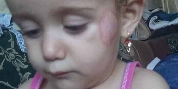 Gəncədə bağçada körpəyə dağ çəkdilər (FOTO)