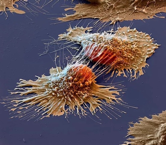 Bax, amma diqqətlə... - FOTOLAR