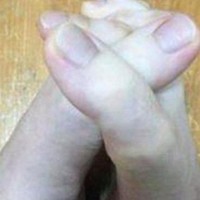 Sosial media bu şəkillərdən danışır - Ayağının şəkillərini paylaşdı... - FOTOLAR