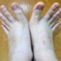 Sosial media bu şəkillərdən danışır - Ayağının şəkillərini paylaşdı... - FOTOLAR