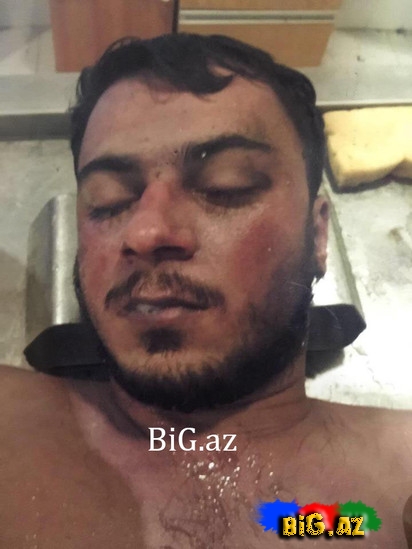 5 gündür morqda qalan gəncin sahibi tapılmır / +18 FOTOLAR