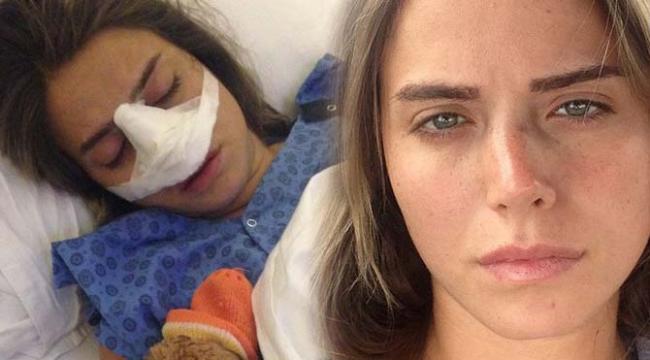 Burnu sınan aktrisa: "şükür ki, əlil olmamışam" - FOTO
