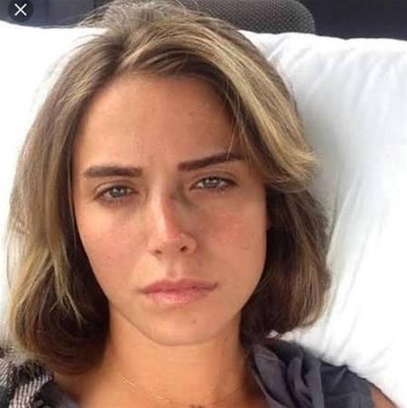 Burnu sınan aktrisa: "şükür ki, əlil olmamışam" - FOTO