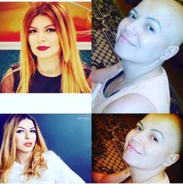 “Hər səhər tüksüz başına baxıb ağlayırsan” - Xərçəng olan aparıcı