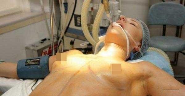 Əməliyyat etdiyi qadınlarını sinəsini çəkdi və... (+18 FOTOLAR)