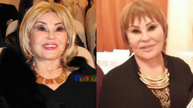 Amaliya Pənahova dəyişib tanınmaz hala düşdü - ŞOK FOTO