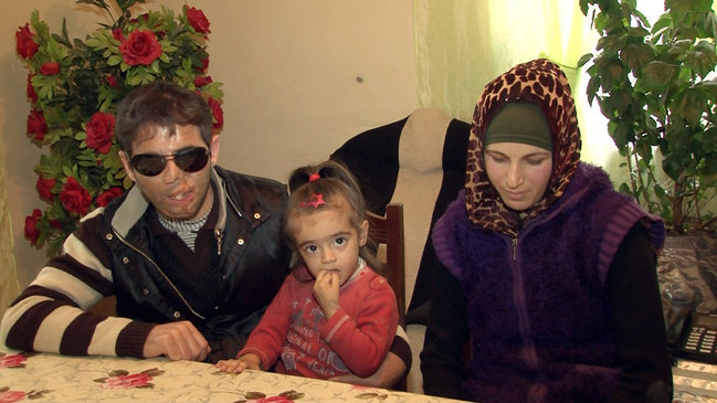 Azərbaycanlı gənc gözlərini sevgisinə qurban verdi: 