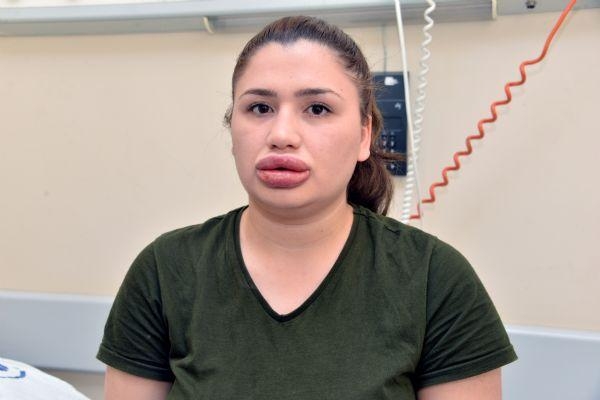 Dodaq qalmaqalının səbəbkarı olan həkimin FOTOSU