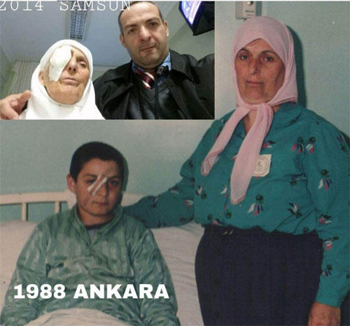 Anası illərlə yolunu gözlədi: "gəldi", başını kəsdi FOTO