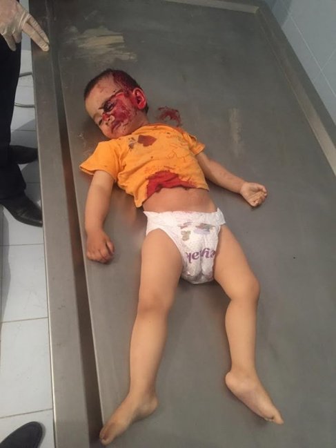 Ermənilərin vəhşicəsinə qətlə yetirdiyi körpə Zöhrənin cəsədi TANINMAZ HALDA (+18 FOTO)