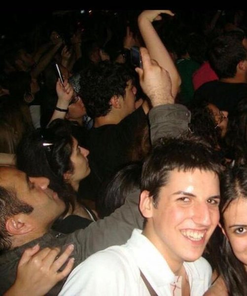 Tanınmış müğənninin plastik əməliyyatdan əvvəlki FOTOLARI ŞOK ETDİ
