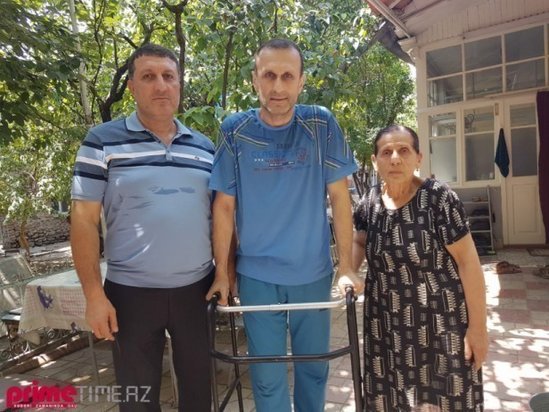 Tanınmış aktyora protez qoyuldu - Foto