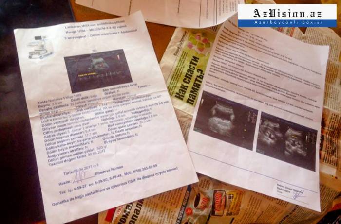 “Elə bil, bizi kimsə yatızdırdı...” – Mələyin öldürüldüyü evdən REPORTAJ (FOTOLAR)