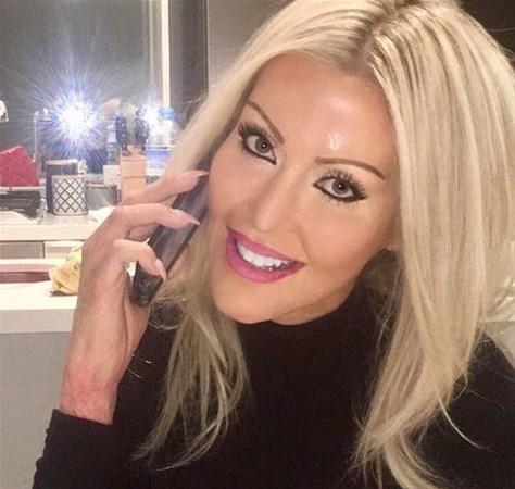 Qısqanc ərin acı intiqamı üzünə kislata tökdü: Qızın isə illər sonrakı halı ŞOK ETDİ - FOTO