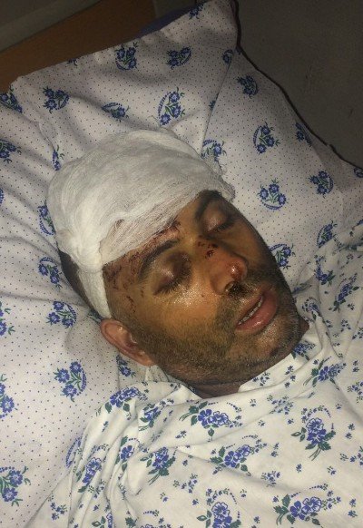 İzzət Bağırovun cangüdənini toyda döyüb BU HALA SALDILAR (+18 FOTOLAR - VİDEO)