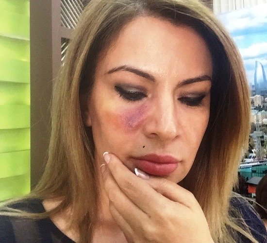 BİABIRÇILIQ! Hesabı ödəməyən aparıcı Ülviranın restoranda görün başına nə oyun açdılar - FOTO