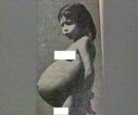 5 yaşında dünyaya uşaq gətirmiş qızcığazın indiki halı və hadisənin dəhşətli detalları. Şok olacaqsınız!(Fotolar)