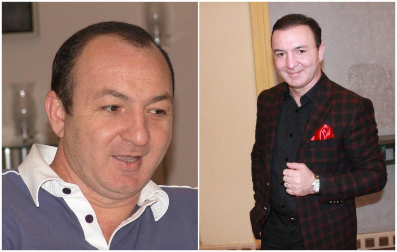 Saç əkdirən azərbaycanlı məşhurların SİYAHISI - FOTO