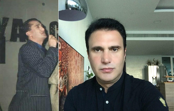 Saç əkdirən azərbaycanlı məşhurların SİYAHISI - FOTO