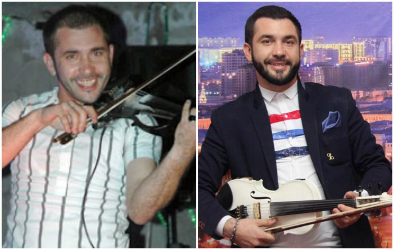 Saç əkdirən azərbaycanlı məşhurların SİYAHISI - FOTO