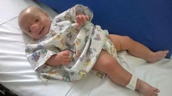 Bu körpənin beyni burnundadır — FOTOLAR