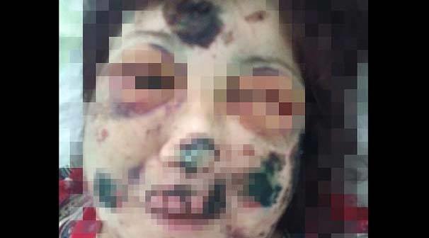 Rusiyada dəhşətli hadisə — İnternetdə tanış olduğu qadını bu hala saldı - FOTOLAR