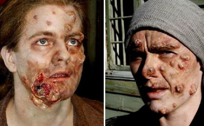 Bu xəstələri ölkədə heç kəs görmür: Hüquq pozuntusu, yoxsa…? (FOTO +18)