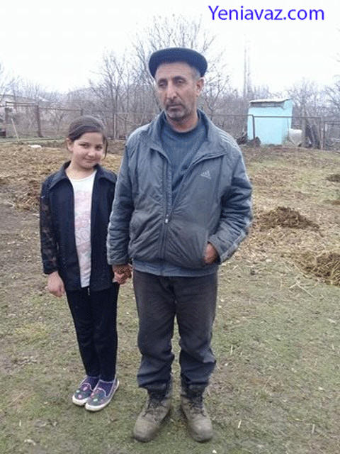 Neçə gündür sosial şəbəkədə fotosu yayılan Mustafa danışdı: "Qızımın da gözündə problem var"