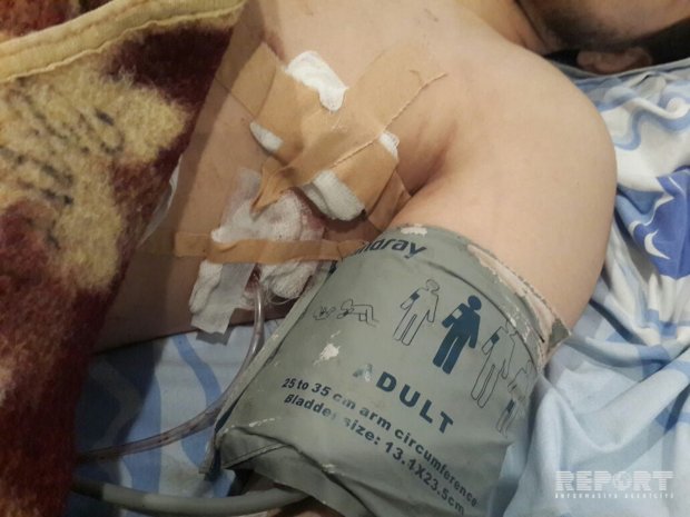 Sumqayıtda kütləvi dava: 2 nəfər yaralandı