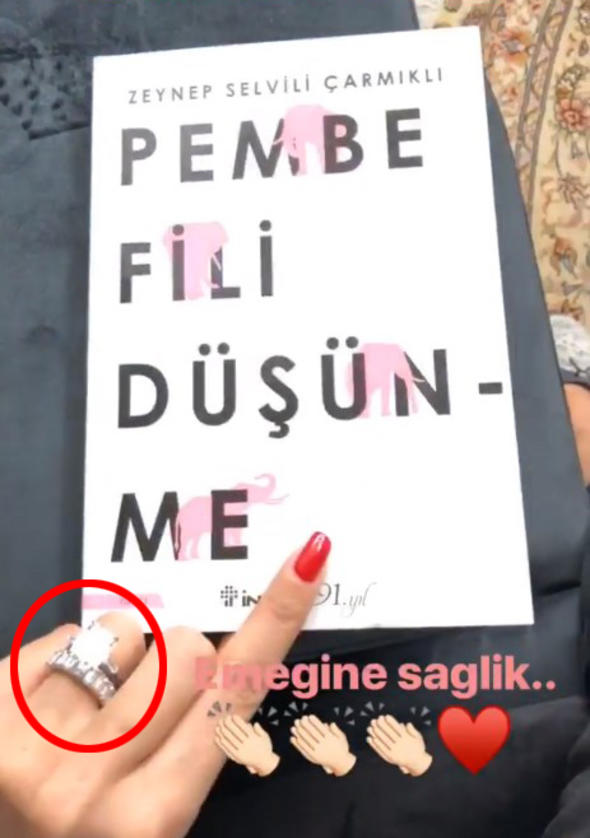 Arda Turanın arvadının 600 minlik üzüyü: Satıb 2 dənə ev almaq olar - FOTO