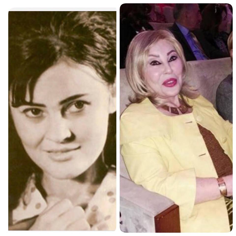 Məşhurlarımızın estetik əməliyyatdan əvvəlki halları - FOTOLAR