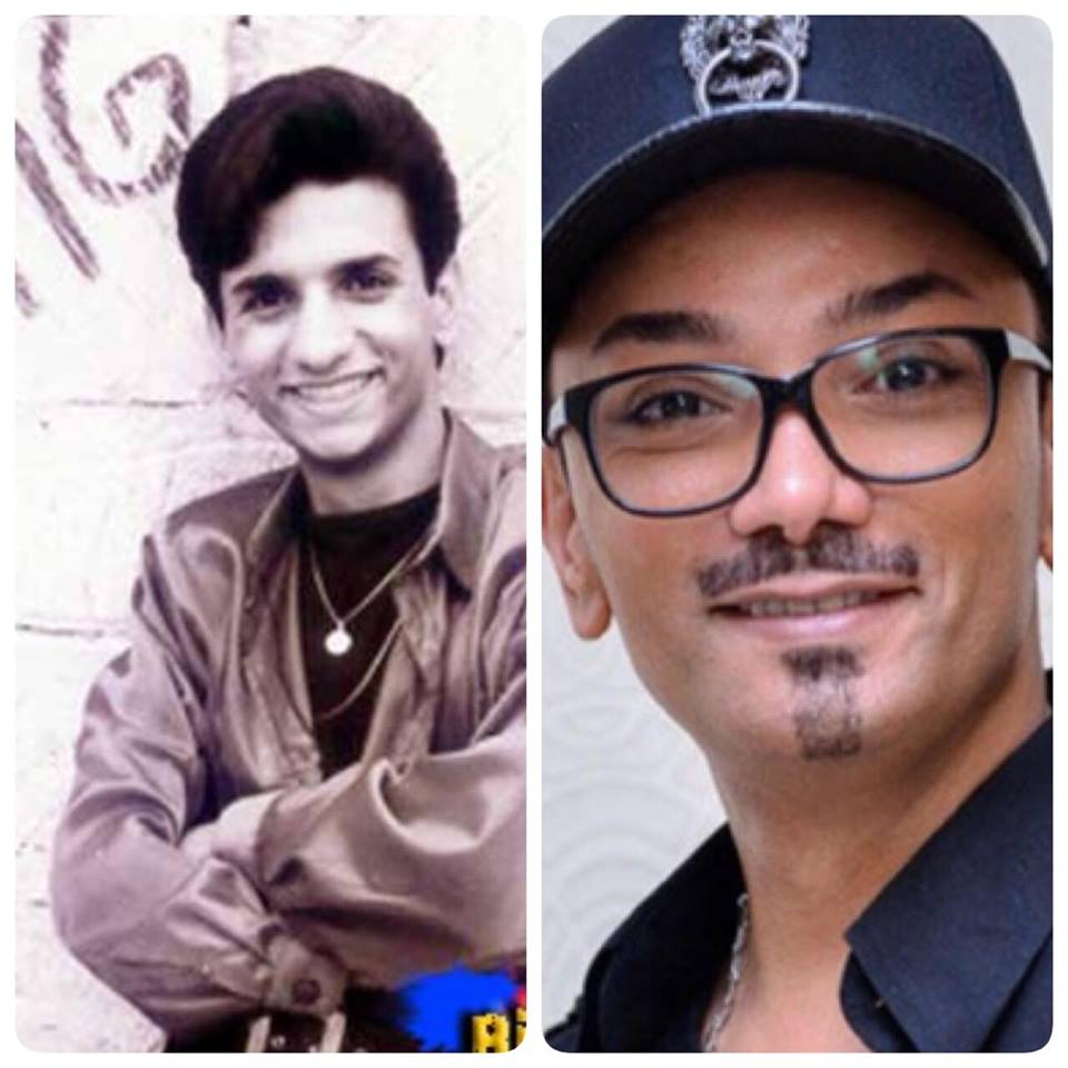 Məşhurlarımızın estetik əməliyyatdan əvvəlki halları - FOTOLAR