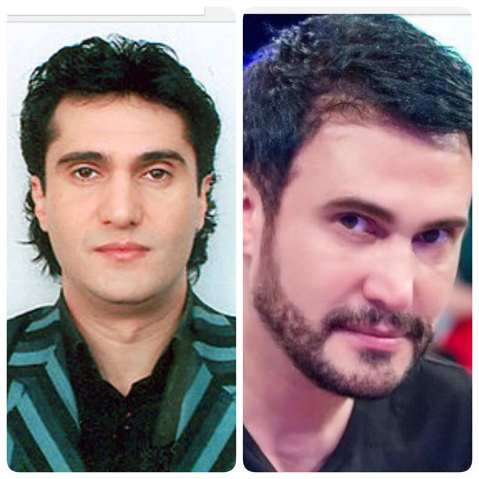 Məşhurlarımızın estetik əməliyyatdan əvvəlki halları - FOTOLAR