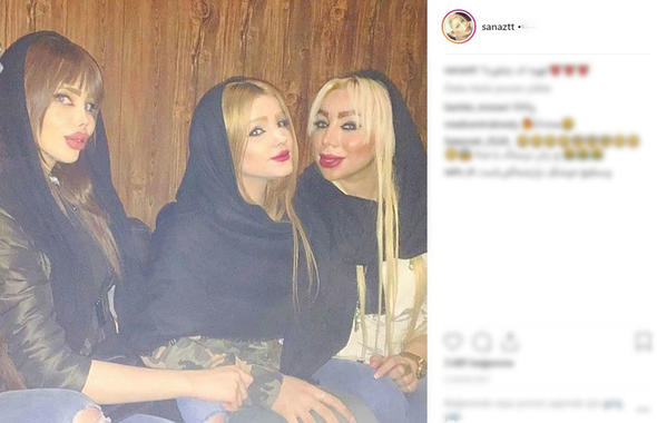 İranın “estetik gözəlləri” - Fotolar