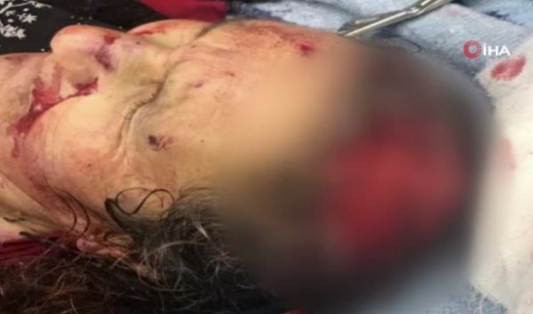 9 küçə iti yaşlı qadını parçaladı – FOTOLAR