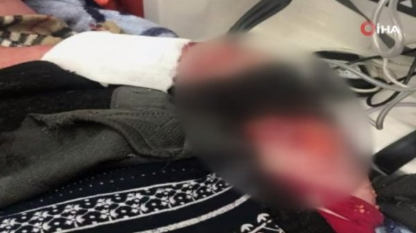9 küçə iti yaşlı qadını parçaladı – FOTOLAR