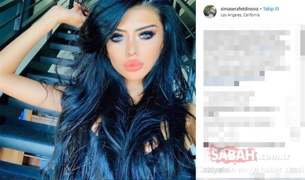 Pilot olan Sima Şərafəddinova keçirdiyi əməliyyatlarla bu hala düşdü - FOTOLAR